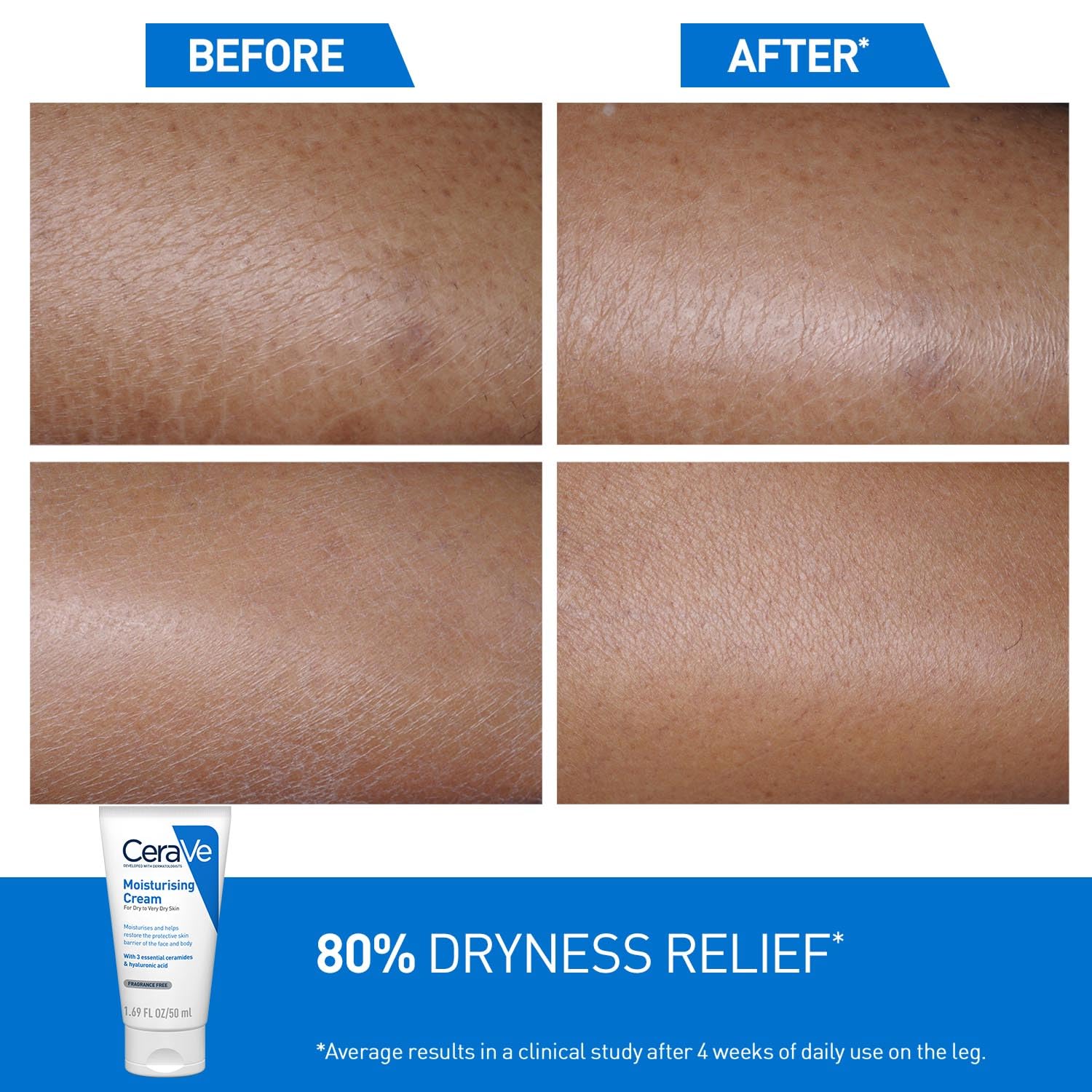 CeraVe Moisturizing Cream For Dry To Very Dry Skin (177ml) - Formulated with 3 Essential Ceramides And Hyaluronic Acid | Non-Comedogenic Moisturizer For Face
