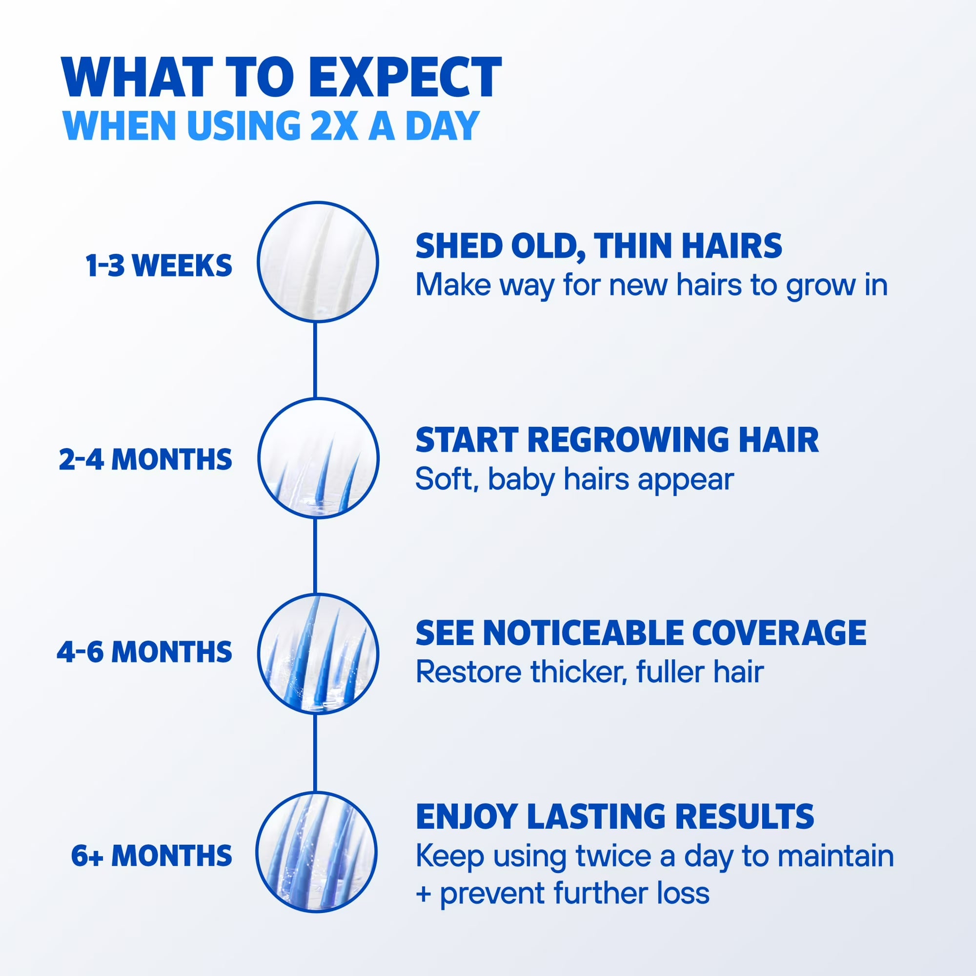 Men's Rogaine 5% Minoxidil Foam Hair Loss Treatment, 1-Month Supply